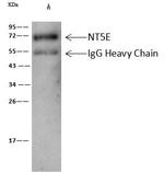 CD73 Antibody in Immunoprecipitation (IP)