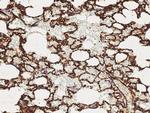 Thrombomodulin Antibody in Immunohistochemistry (Paraffin) (IHC (P))