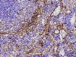 Thrombomodulin Antibody in Immunohistochemistry (Paraffin) (IHC (P))