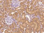 B7-H4 Antibody in Immunohistochemistry (Paraffin) (IHC (P))