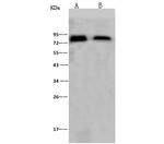 Influenza A H1N1 HA (A/Puerto Rico/8/34) Antibody in Western Blot (WB)