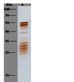 SARS Coronavirus Nucleocapsid Antibody in Western Blot (WB)