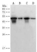 SARS/SARS-CoV-2 Nucleocapsid Antibody in Western Blot (WB)