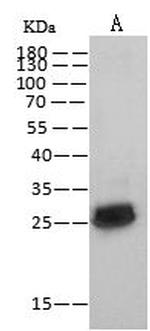 HIV1 p24 (group N, strain 06CM-U14296) Antibody in Western Blot (WB)