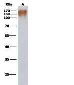 HIV1 gp120 (group P, strain RBF168) Antibody in Western Blot (WB)