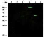 Ebola Virus VP40 (subtype Zaire, strain H.sapiens-wt/GIN/2014/Kissidougou-C15) Antibody in Western Blot (WB)