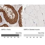 G6PD Antibody