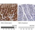 Radixin Antibody