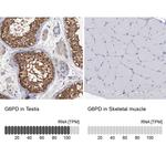 G6PD Antibody