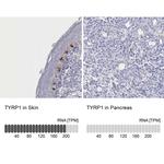 TYRP1 Antibody