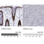 SATB2 Antibody