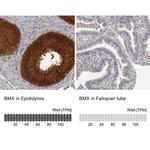 ETK Antibody