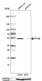 ATP Synthase beta Antibody