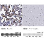 CD36 Antibody