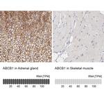 P-Glycoprotein Antibody