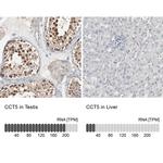 TCP-1 epsilon Antibody