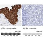 Cytokeratin 19 Antibody