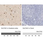 SULT4A1 Antibody