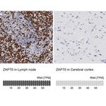 Zap-70 Antibody