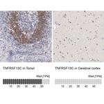 CD268 (BAFF Receptor) Antibody