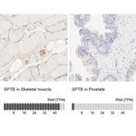 SPTBN1 Antibody