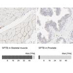 SPTBN1 Antibody