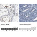 SOX6 Antibody