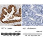 Prostate Specific Acid Phosphatase Antibody