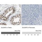 DLG7 Antibody