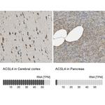 ACSL4 Antibody