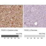 Fascin Antibody