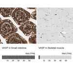 VASP Antibody