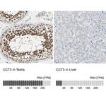 TCP-1 epsilon Antibody