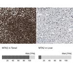 MTA2 Antibody