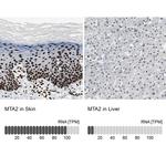 MTA2 Antibody