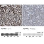 ACAA1 Antibody