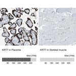 Cytokeratin 7 Antibody