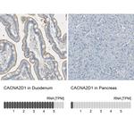 CACNA2D1 Antibody
