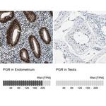 Progesterone Receptor Antibody