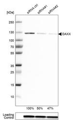 DAXX Antibody