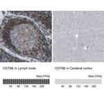 CD79b Antibody