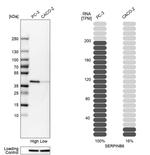 SERPINB6 Antibody