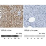 ACMSD Antibody