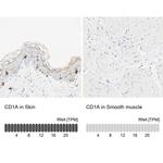 CD1a Antibody