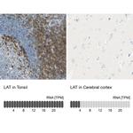 LAT Antibody