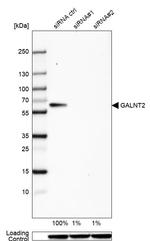 GALNT2 Antibody