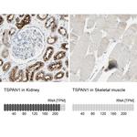 TSPAN1 Antibody