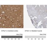 Synaptojanin 1 Antibody