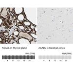 ACADL Antibody