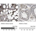 Annexin A3 Antibody